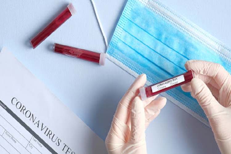 رعایت فاصله ۱.۵ متری قدرت شیوع کرونا را کاهش میدهد رعایت فاصله ۱.۵ متری قدرت شیوع کرونا را کاهش میدهد