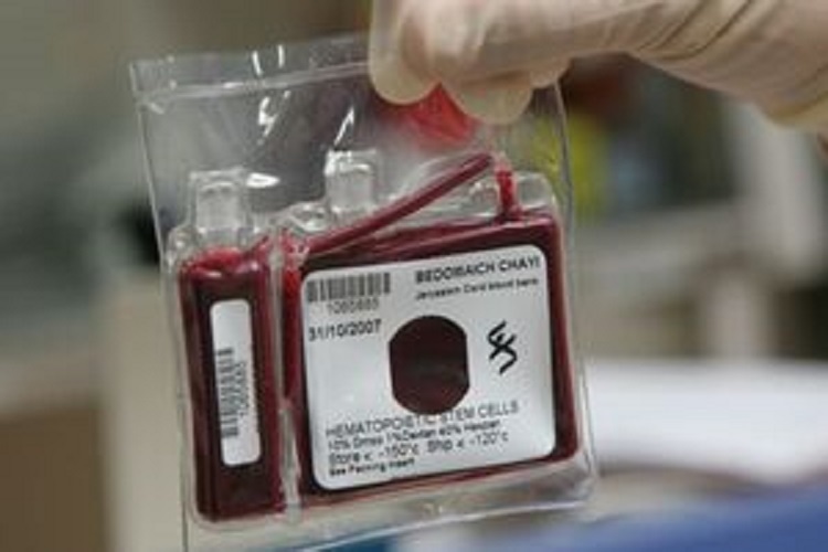 خون بند ناف خون بند ناف